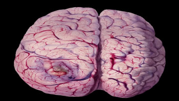 Atom the Amazing Zombie Killer (2012) download